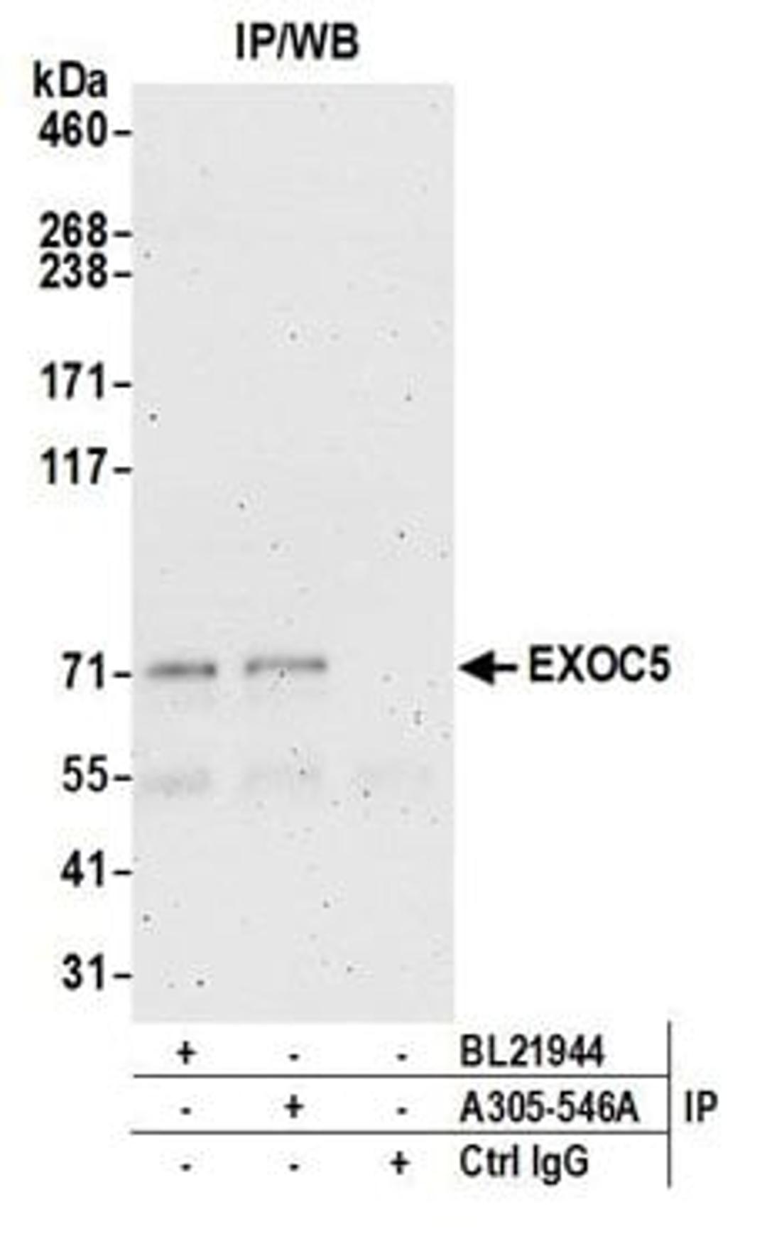 Detection of human EXOC5 by western blot of immunoprecipitates.