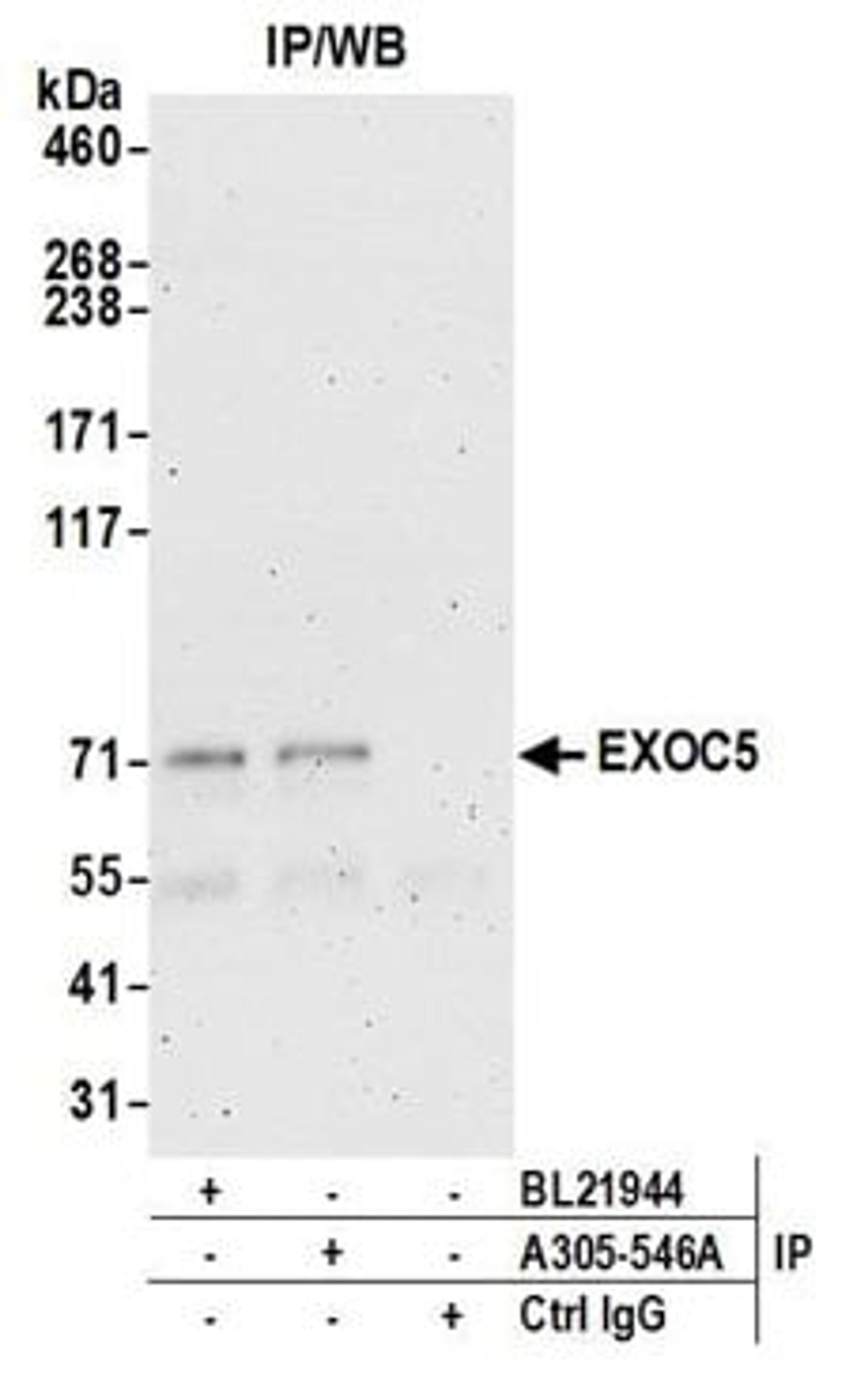 Detection of human EXOC5 by western blot of immunoprecipitates.