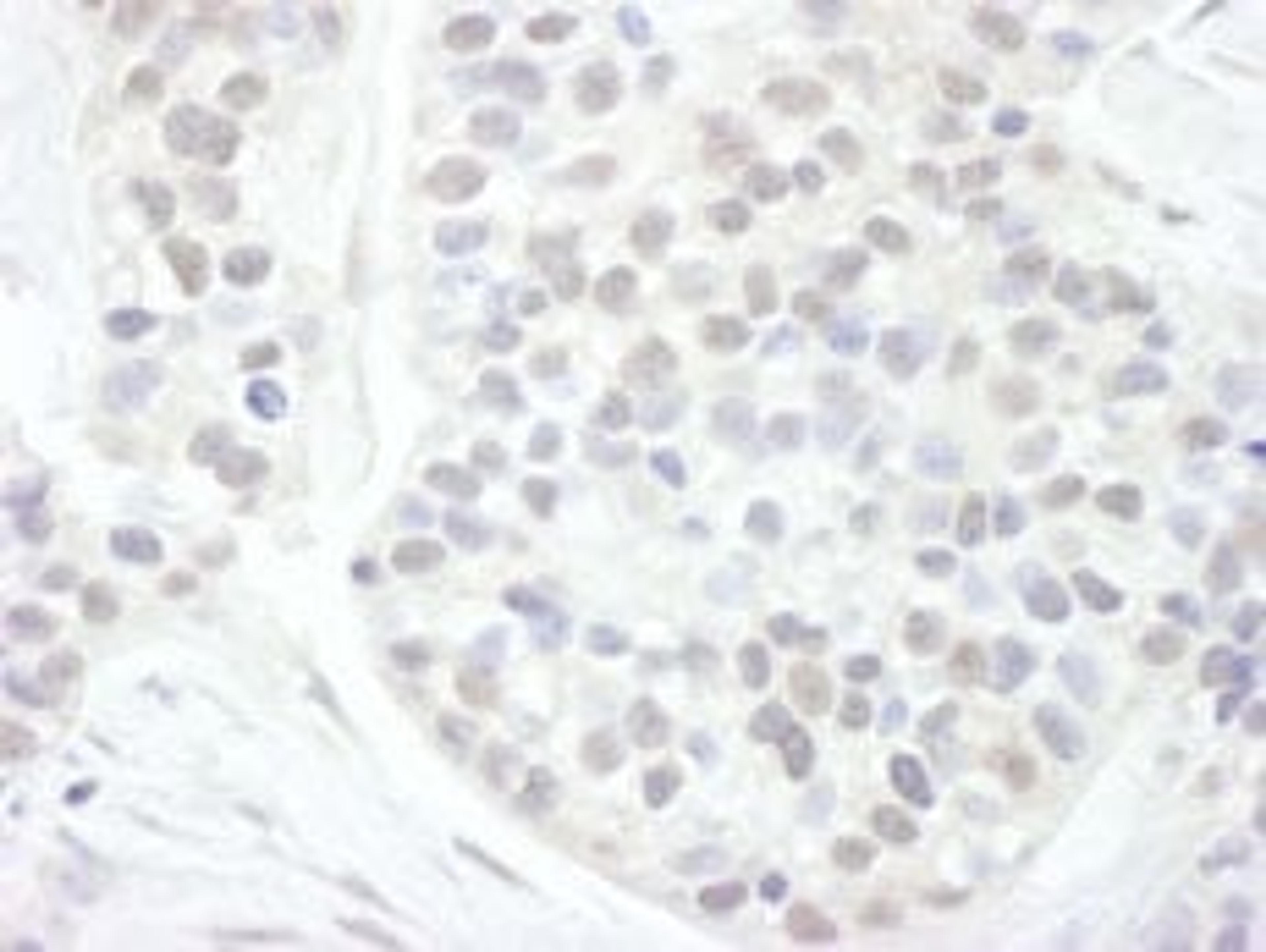 Detection of human Cyclin T1 by immunohistochemistry.