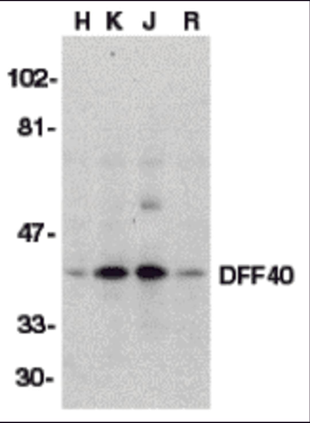 Western blot analysis of DFF40 in HeLa (H), K562 (K), Jurkat (J), and Raji (R) whole cell lysate with DFF40 antibody (I18) at 1:500 dilution.