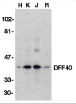 Western blot analysis of DFF40 in HeLa (H), K562 (K), Jurkat (J), and Raji (R) whole cell lysate with DFF40 antibody (I18) at 1:500 dilution.