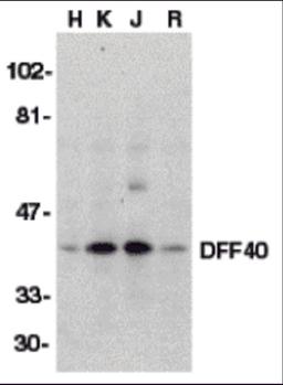 Western blot analysis of DFF40 in HeLa (H), K562 (K), Jurkat (J), and Raji (R) whole cell lysate with DFF40 antibody (I18) at 1:500 dilution.