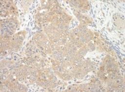 Detection of mouse NEDD4L by immunohistochemistry.