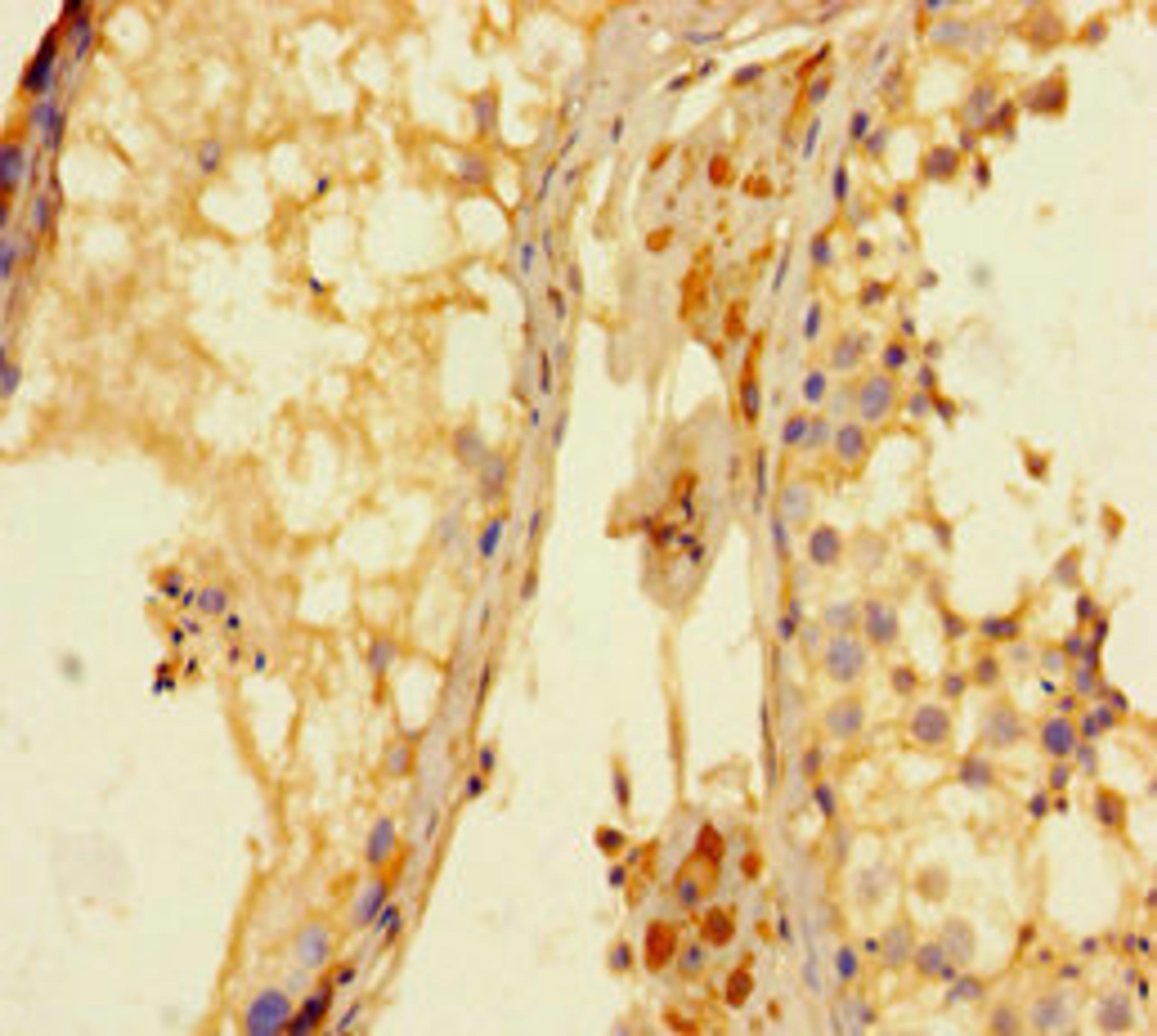 Immunohistochemistry of paraffin-embedded human testis tissue using CSB-PA012137LA01HU at dilution of 1:100