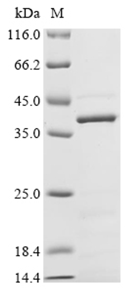 (Tris-Glycine gel) Discontinuous SDS-PAGE (reduced) with 5% enrichment gel and 15% separation gel.