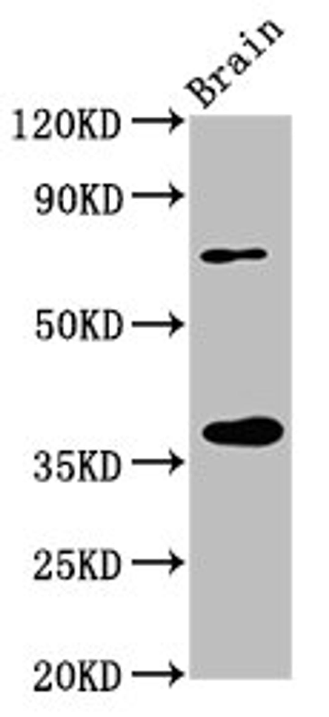 Western Blot. Positive WB detected in: Rat brain tissue. All lanes: EIF3I antibody at 3.2µg/ml. Secondary. Goat polyclonal to rabbit IgG at 1/50000 dilution. Predicted band size: 37 kDa. Observed band size: 37 kDa
