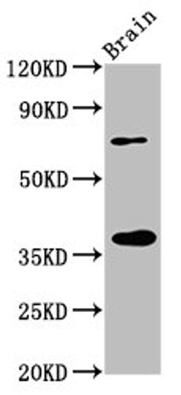 Western Blot. Positive WB detected in: Rat brain tissue. All lanes: EIF3I antibody at 3.2µg/ml. Secondary. Goat polyclonal to rabbit IgG at 1/50000 dilution. Predicted band size: 37 kDa. Observed band size: 37 kDa