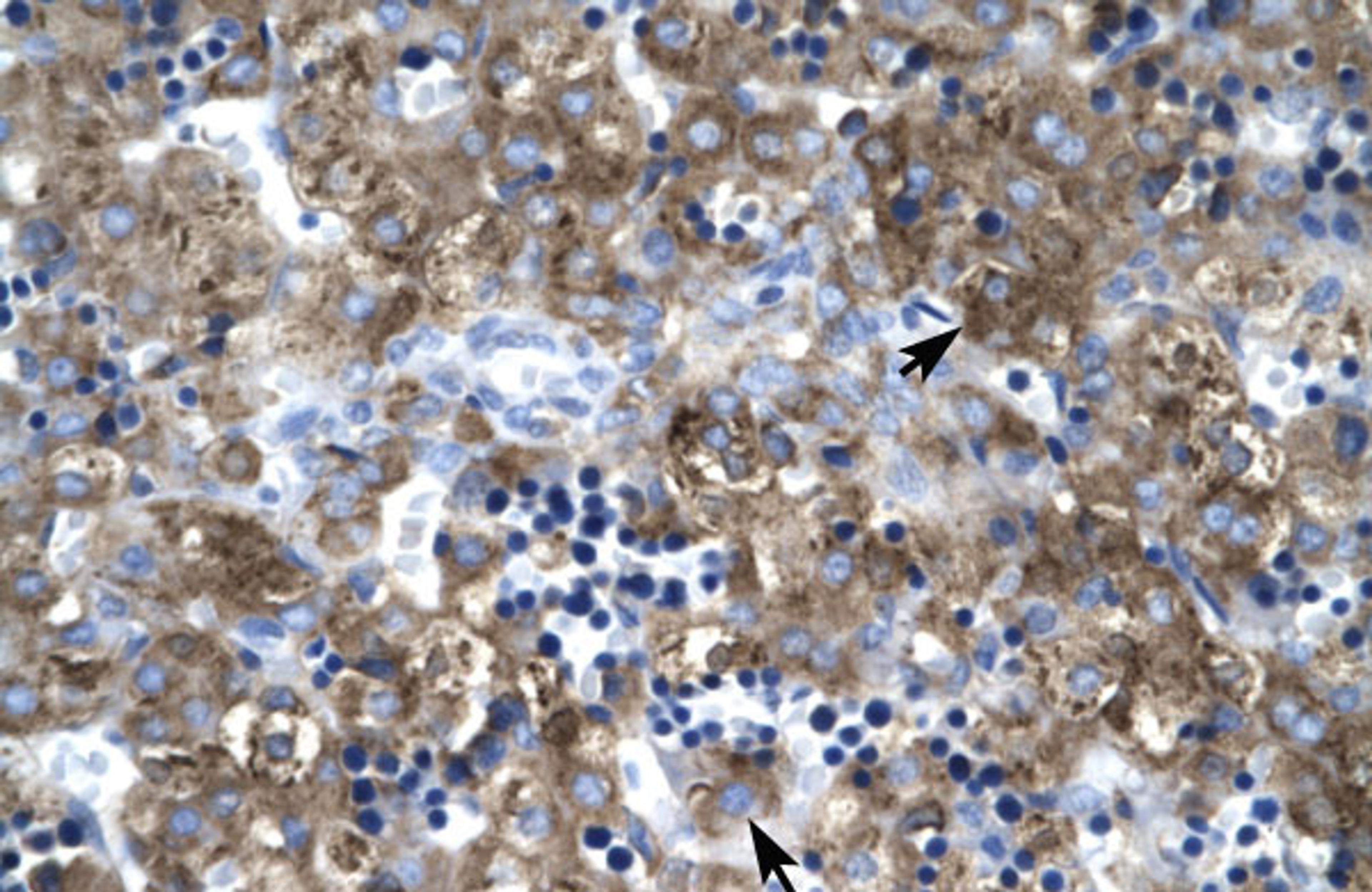 Antibody used in IHC on Human Liver.