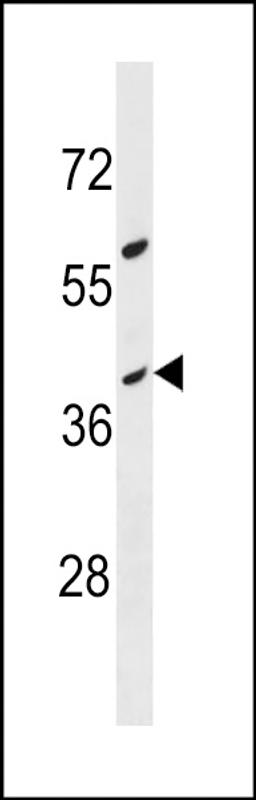 Western blot analysis in MDA-MB453 cell line lysates (35ug/lane).