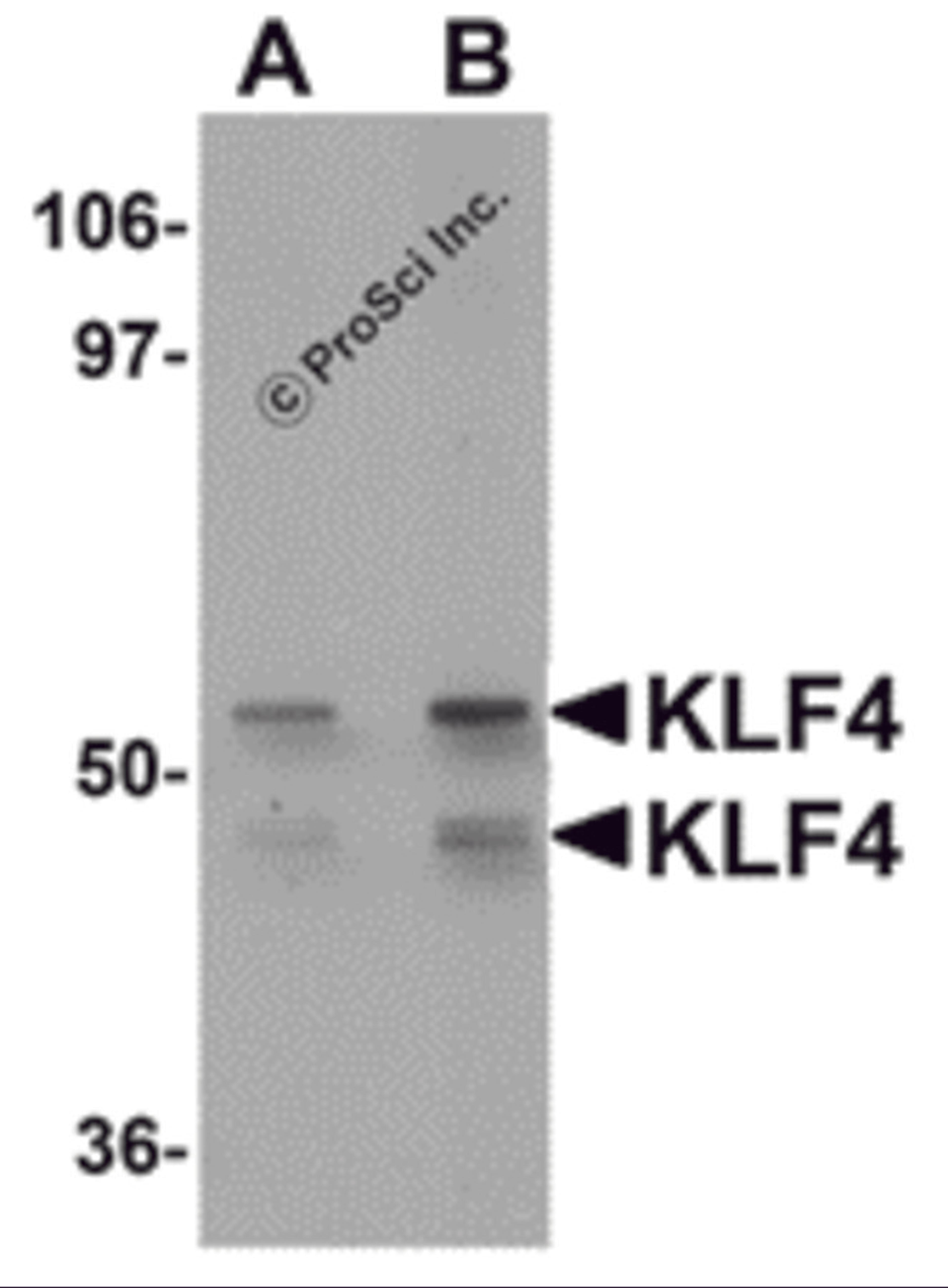 Western blot analysis of KLF4 in human liver tissue lysate with KLF4 antibody at (A) 1 and (B) 2 &#956;g/mL.