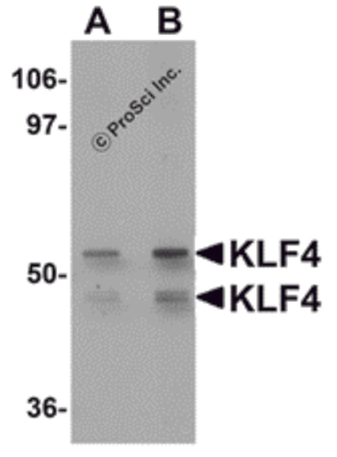 Western blot analysis of KLF4 in human liver tissue lysate with KLF4 antibody at (A) 1 and (B) 2 μg/mL.