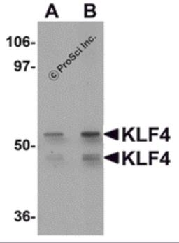Western blot analysis of KLF4 in human liver tissue lysate with KLF4 antibody at (A) 1 and (B) 2 μg/mL.