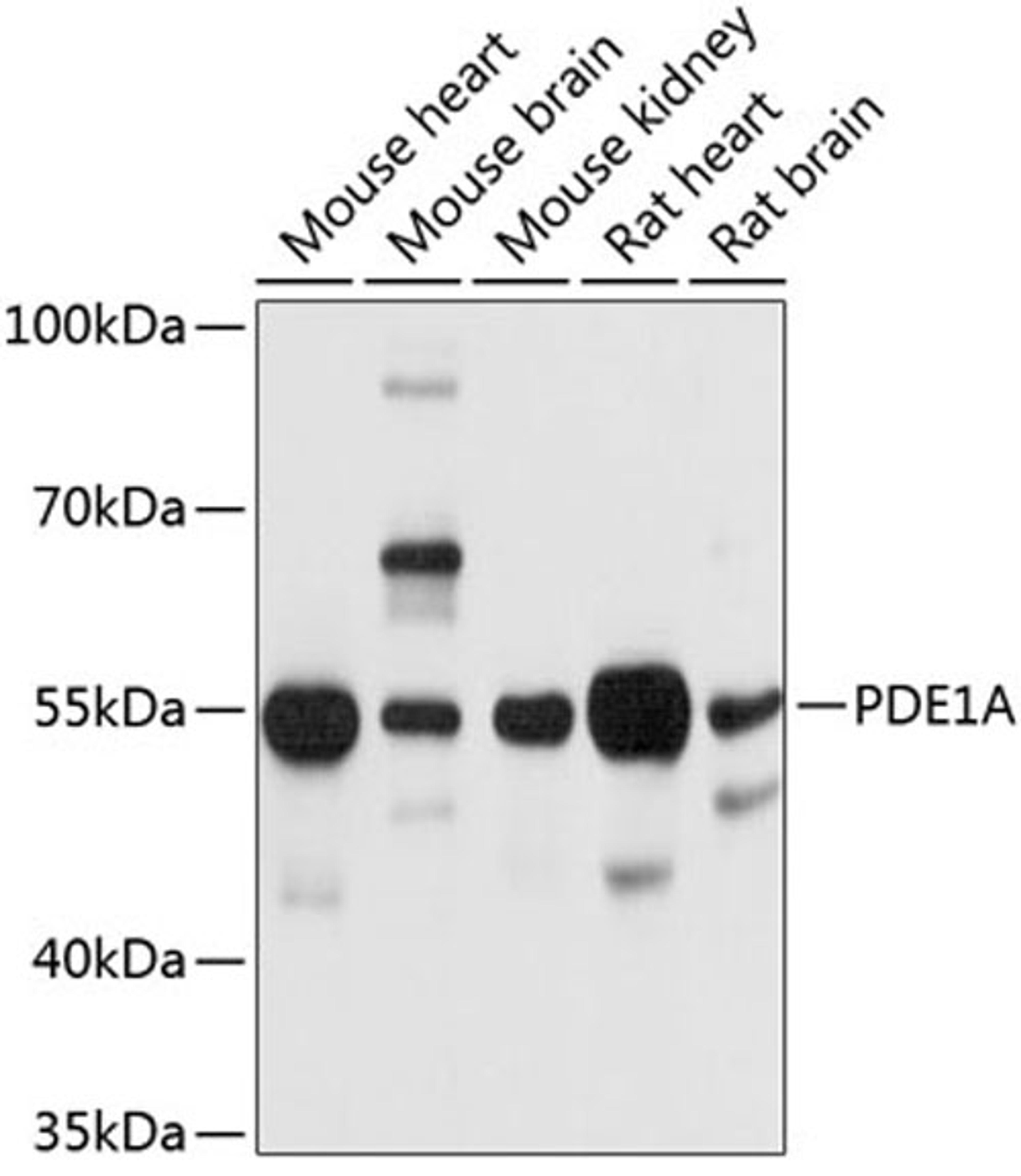 Western blot - PDE1A antibody (A10457)