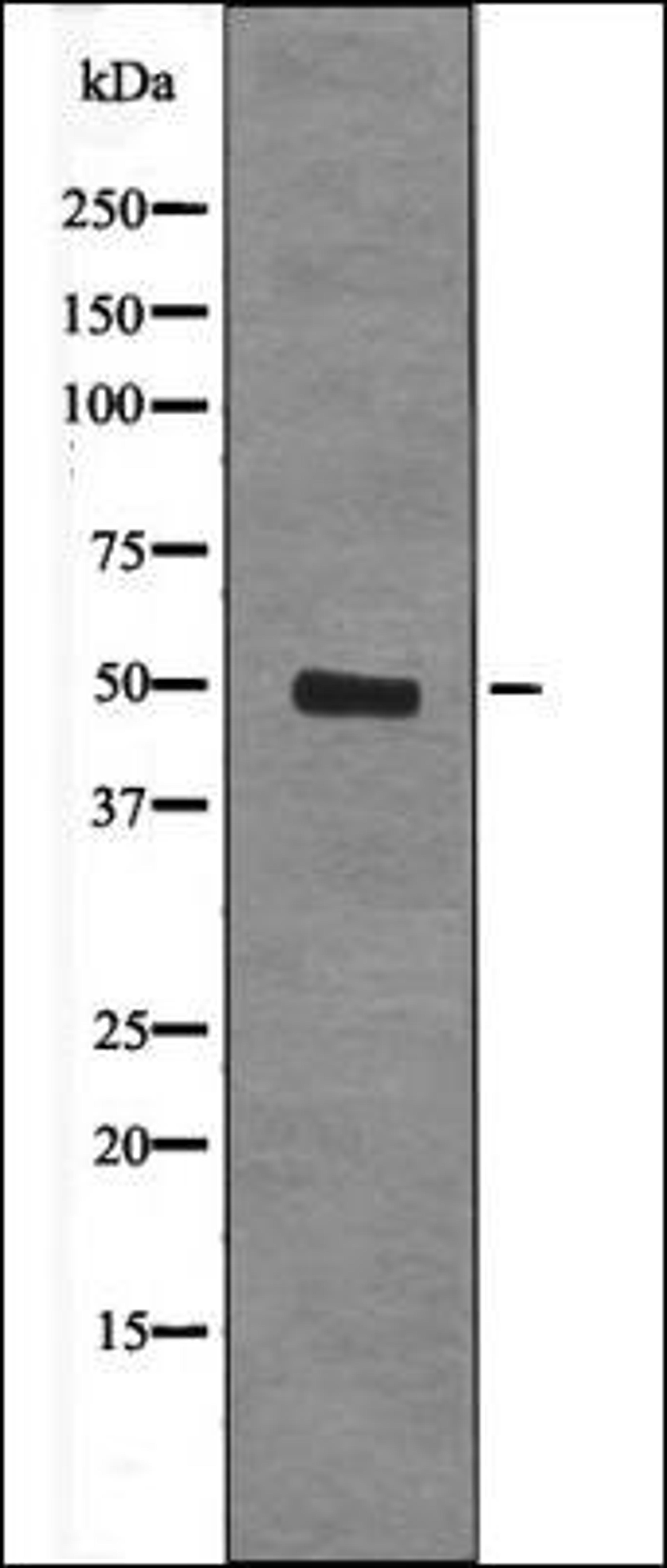 Western blot analysis of Forskolin treated HepG2 whole cell lysates using CtBP1/2 -Phospho-Ser158/164- antibody