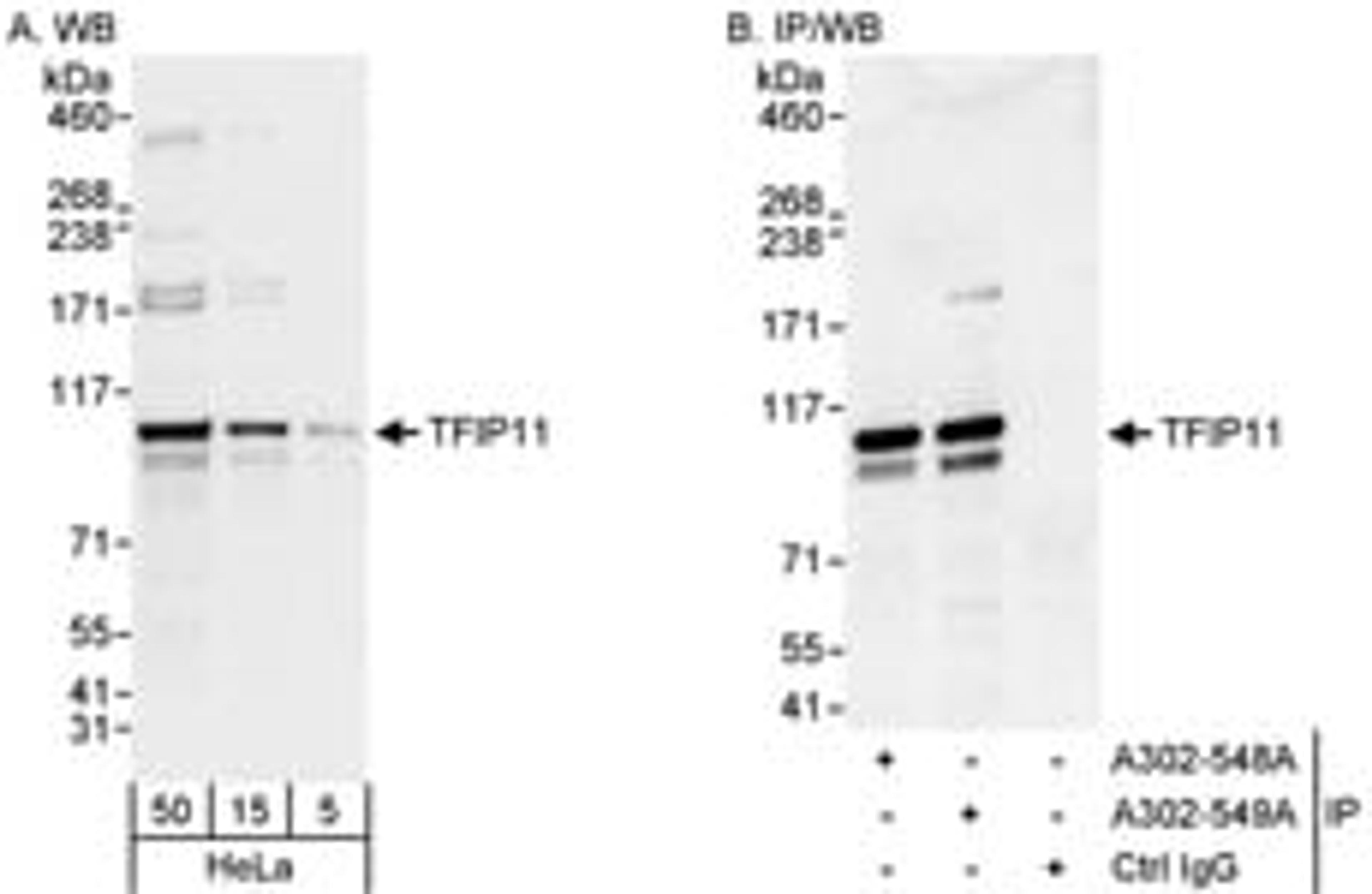 Detection of human TFIP11 by western blot and immunoprecipitation.