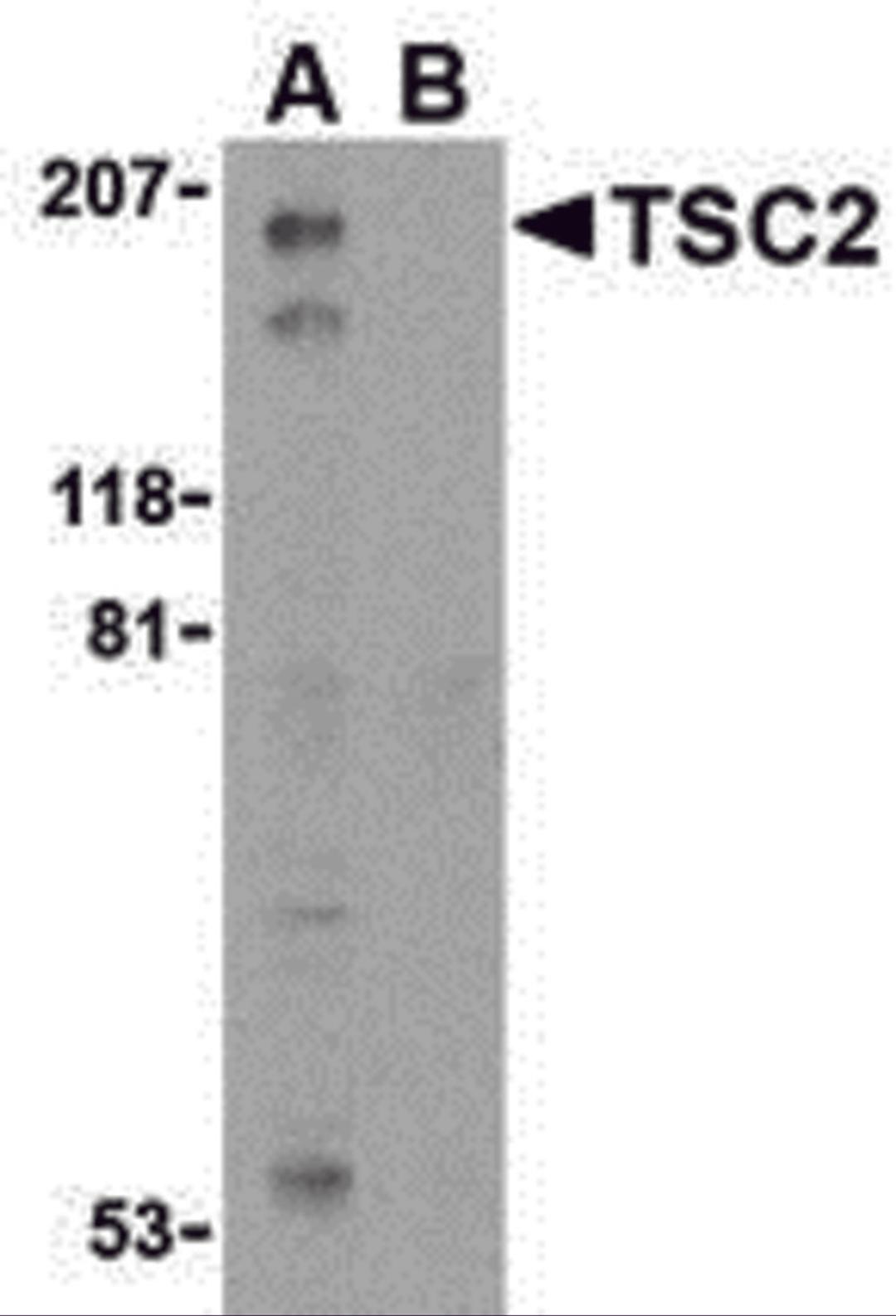 Western blot analysis of TSC2 in L1210 cell lysate with TSC2 antibody at 1 &#956;g/mL in the (A) absence and (B) presence of blocking peptide.