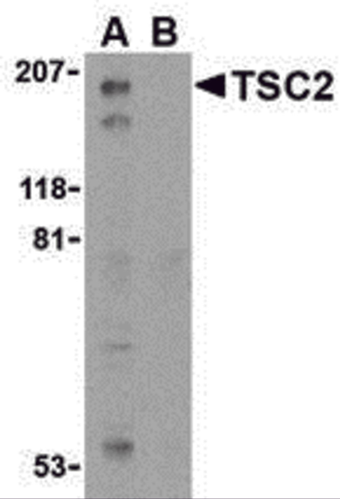 Western blot analysis of TSC2 in L1210 cell lysate with TSC2 antibody at 1 μg/mL in the (A) absence and (B) presence of blocking peptide.