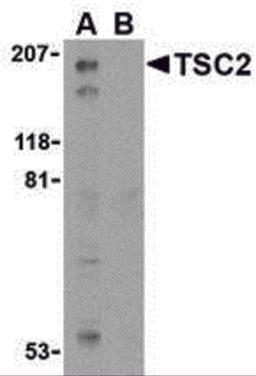 Western blot analysis of TSC2 in L1210 cell lysate with TSC2 antibody at 1 μg/mL in the (A) absence and (B) presence of blocking peptide.