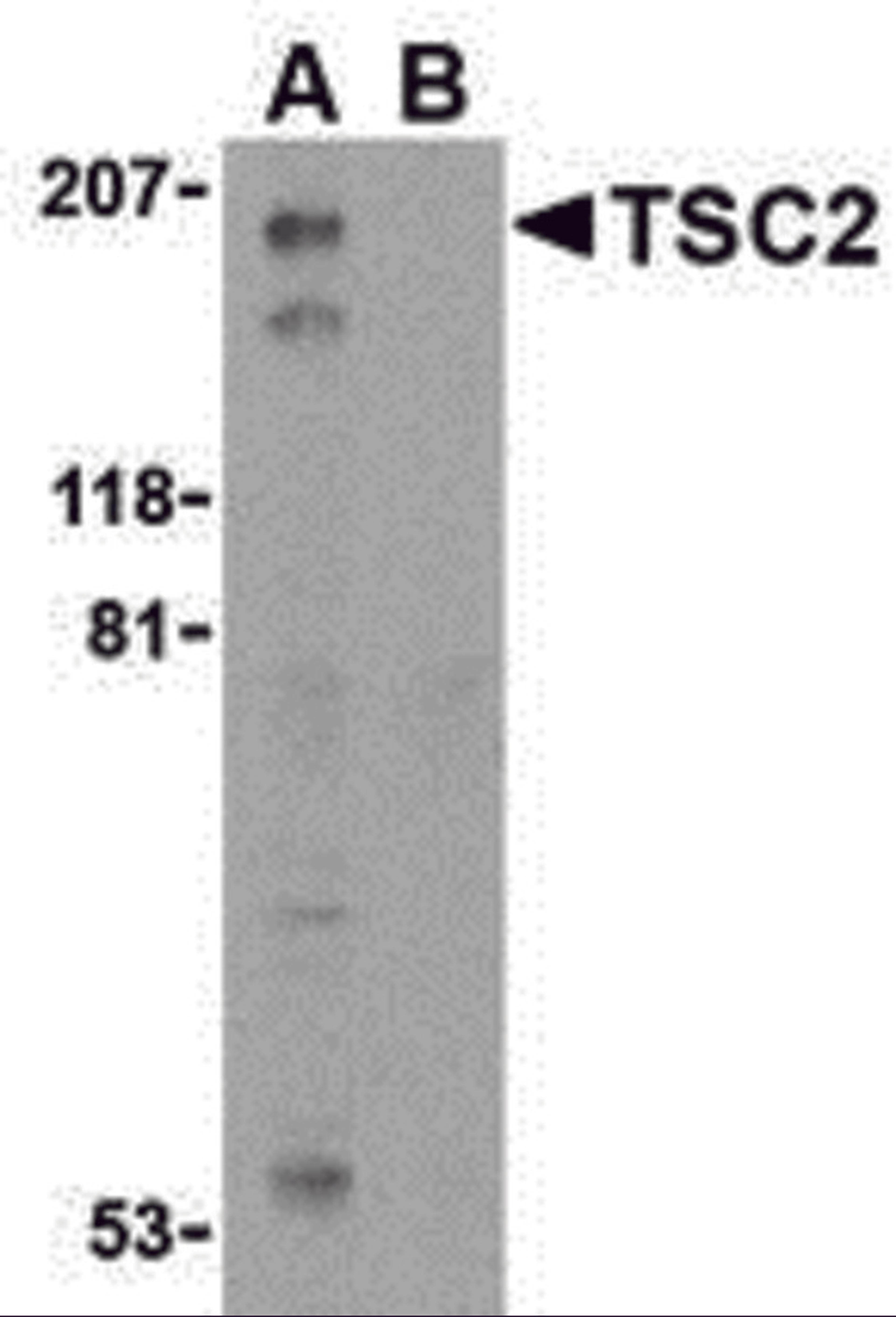 Western blot analysis of TSC2 in L1210 cell lysate with TSC2 antibody at 1 μg/mL in the (A) absence and (B) presence of blocking peptide.