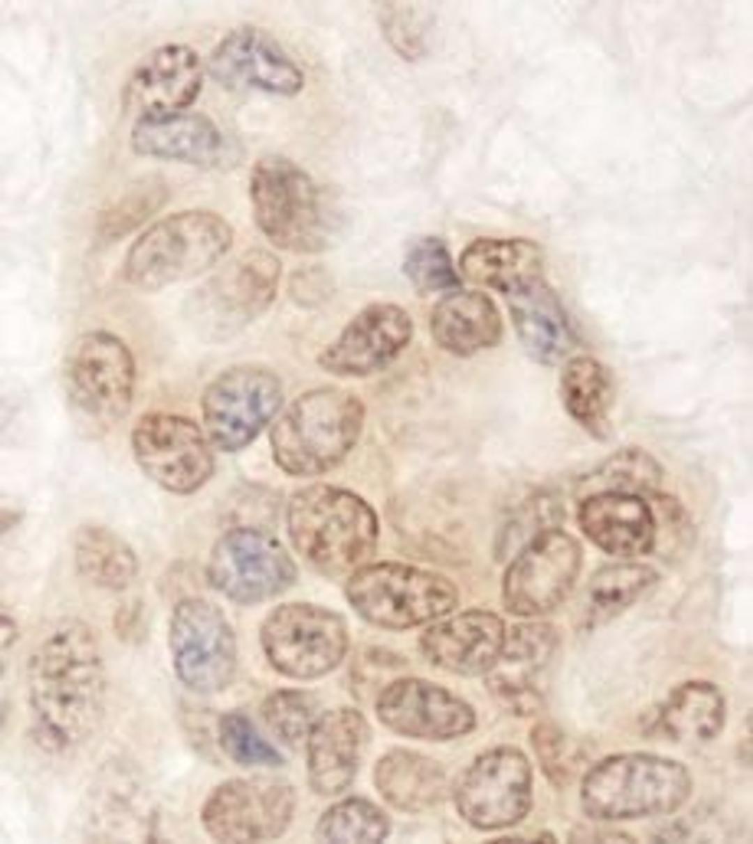 Detection of human QSER1 by immunohistochemistry.