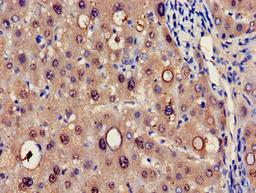 Immunohistochemistry of paraffin-embedded human liver tissue using CSB-PA010744LA01HU at dilution of 1:100
