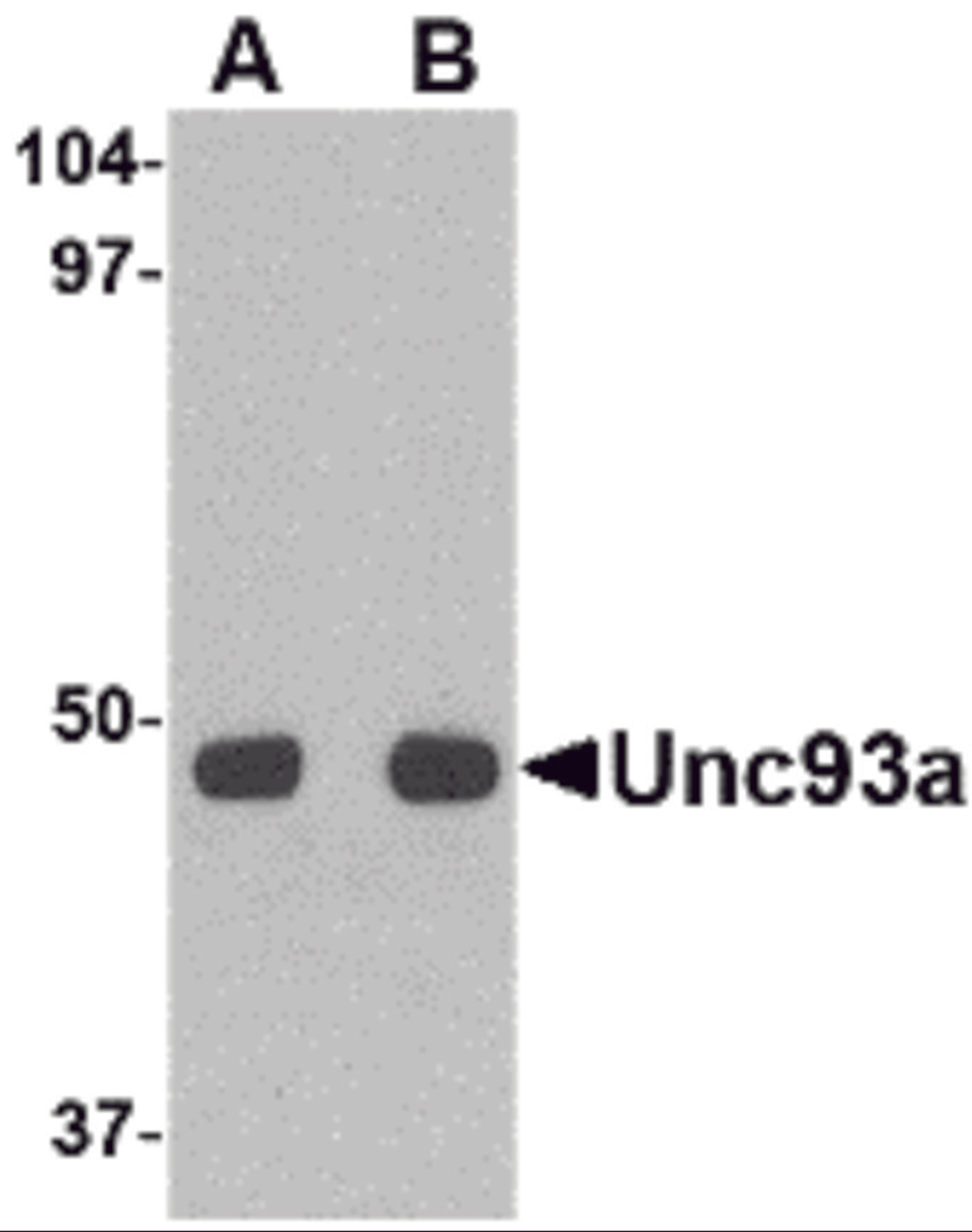 Western blot analysis of Unc93a in HeLa cell lysate with Unc93a antibody at (A) 0.5 and (B) 1 &#956;g/mL.