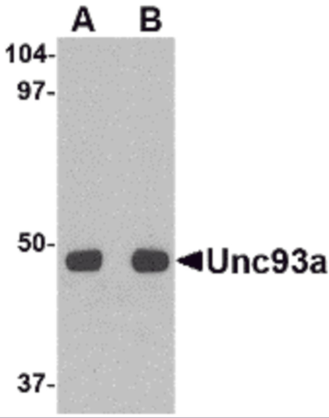 Western blot analysis of Unc93a in HeLa cell lysate with Unc93a antibody at (A) 0.5 and (B) 1 μg/mL.
