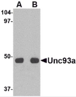 Western blot analysis of Unc93a in HeLa cell lysate with Unc93a antibody at (A) 0.5 and (B) 1 μg/mL.