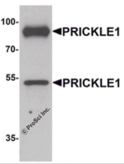 Western blot analysis of PRICKLE1 in human bladder tissue lysate with PRICKLE1 antibody at 1 &#956;g/mL.