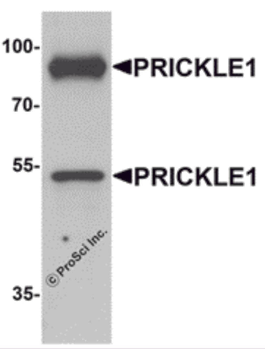 Western blot analysis of PRICKLE1 in human bladder tissue lysate with PRICKLE1 antibody at 1 μg/mL.