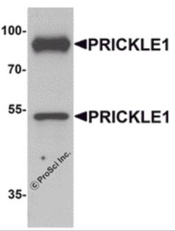 Western blot analysis of PRICKLE1 in human bladder tissue lysate with PRICKLE1 antibody at 1 μg/mL.