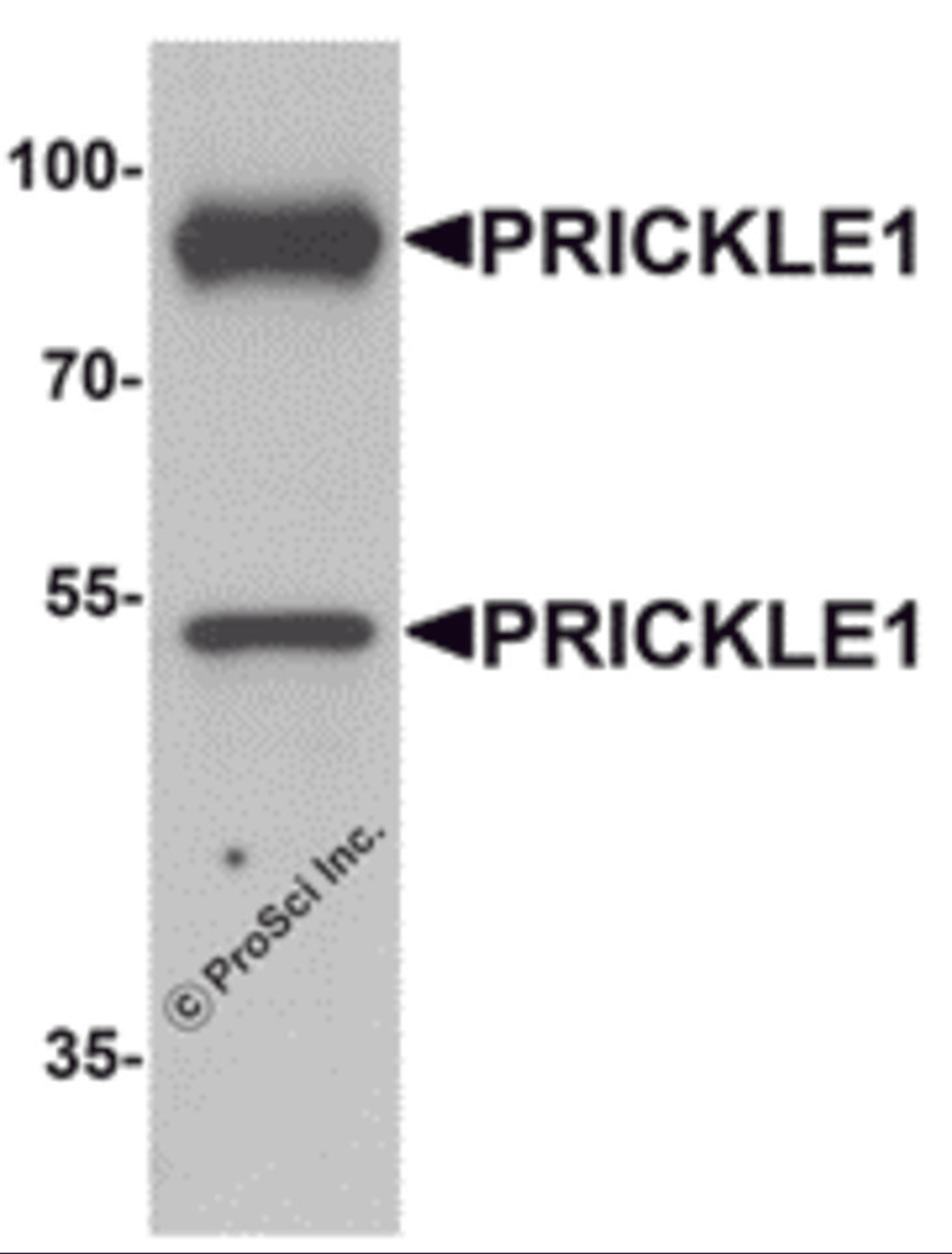Western blot analysis of PRICKLE1 in human bladder tissue lysate with PRICKLE1 antibody at 1 μg/mL.