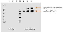 Western Blot: Transferrin Antibody (HTF-14) [NB500-418] - Analysis using the Azide Free version of NB500-418. Detection of 1. hTransferrin; 5 ug/well (red. con.) 2. hTransferrin; 3 ug/well (red. con.) 3. hTransferrin; 1 ug/well (red. con.) M. Low Range marker 4. hTransferrin; 1 ug/well (non-red. con.) 5. hTransferrin; 3 ug/well (non-red. con.)  6. hTransferrin; 5 ug/well (non-red. con.)