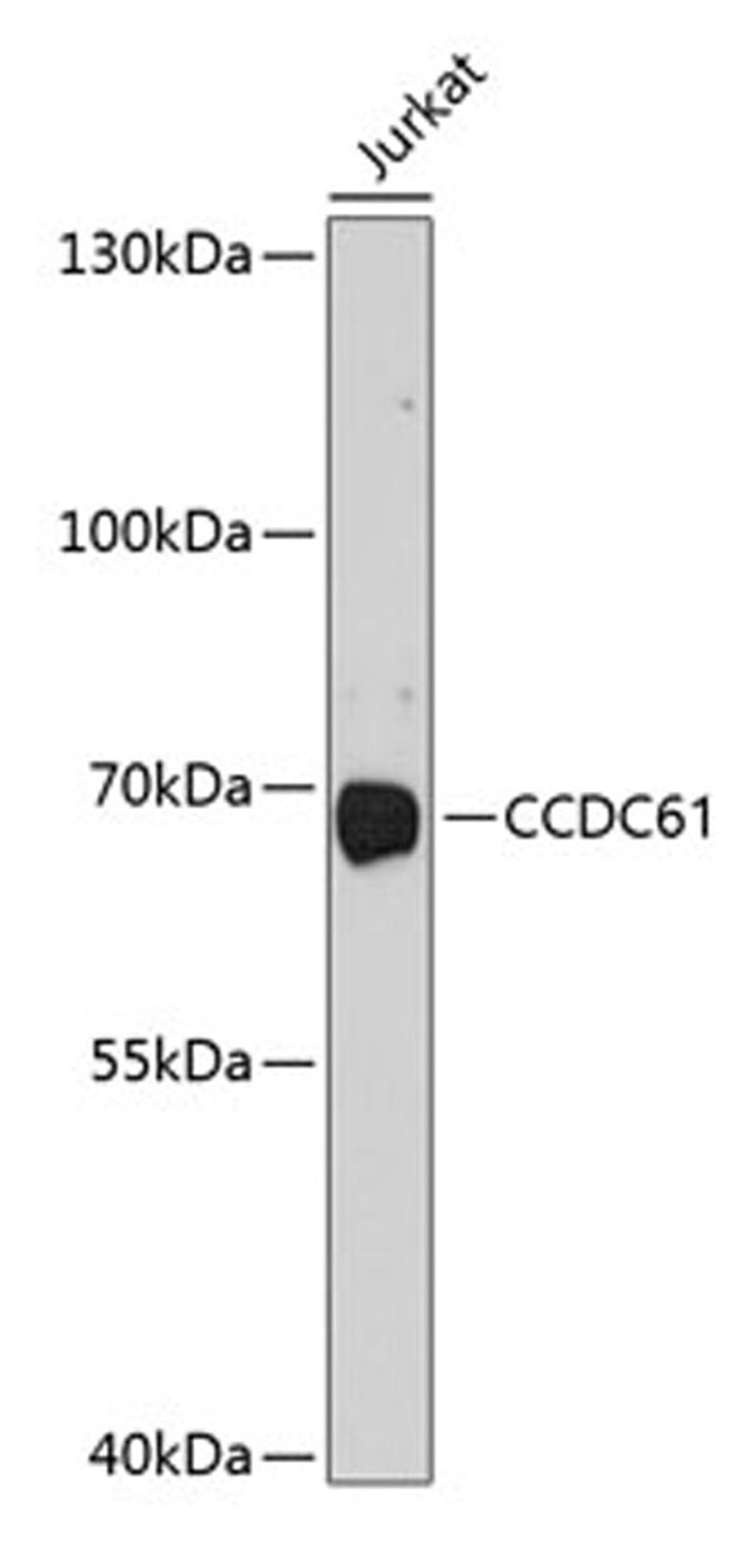 Western blot - CCDC61 antibody (A10341)