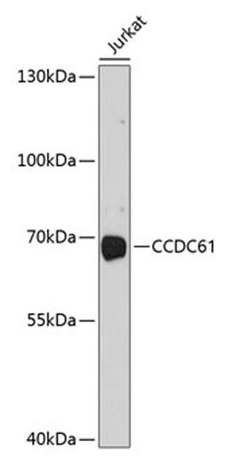 Western blot - CCDC61 antibody (A10341)