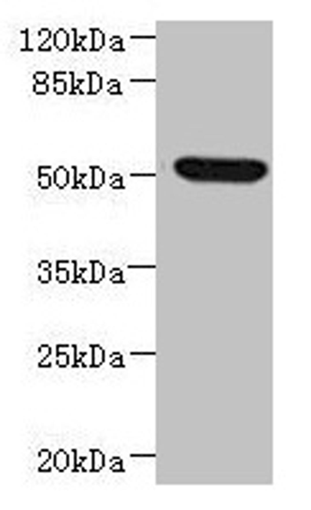 Western blot. All lanes: NDUFV1 antibody at 3.46µg/ml + HepG2 whole cell lysate. Secondary. Goat polyclonal to rabbit IgG at 1/10000 dilution. Predicted band size: 51, 50 kDa. Observed band size: 51 kDa