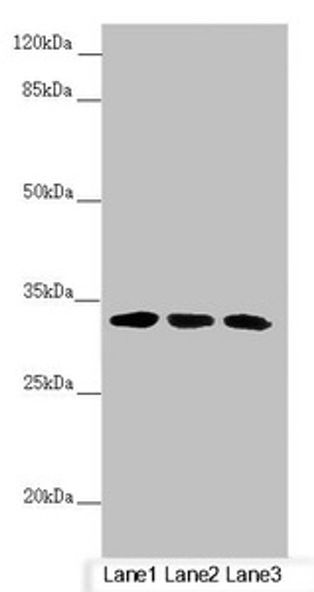 Western blot. All lanes: CENPK antibody at 4.17µg/ml. Lane 1: PC-3 whole cell lysate. Lane 2: 293T whole cell lysate. Lane 3: Hela whole cell lysate. Secondary. Goat polyclonal to rabbit IgG at 1/10000 dilution. Predicted band size: 32 kDa. Observed band size: 32 kDa