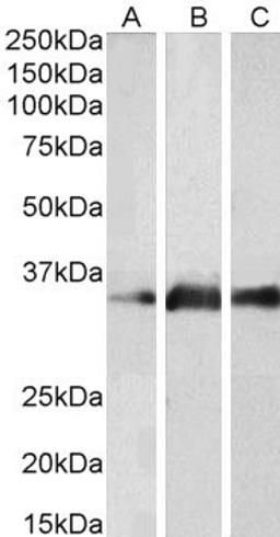 45-809 (2ug/ml) staining of Human Brain (Cerebellum) (A), Mouse Brain (B) and Rat Brain (C) lysates (35ug protein in RIPA buffer). Primary incubation was 1 hour. Detected by chemiluminescence.