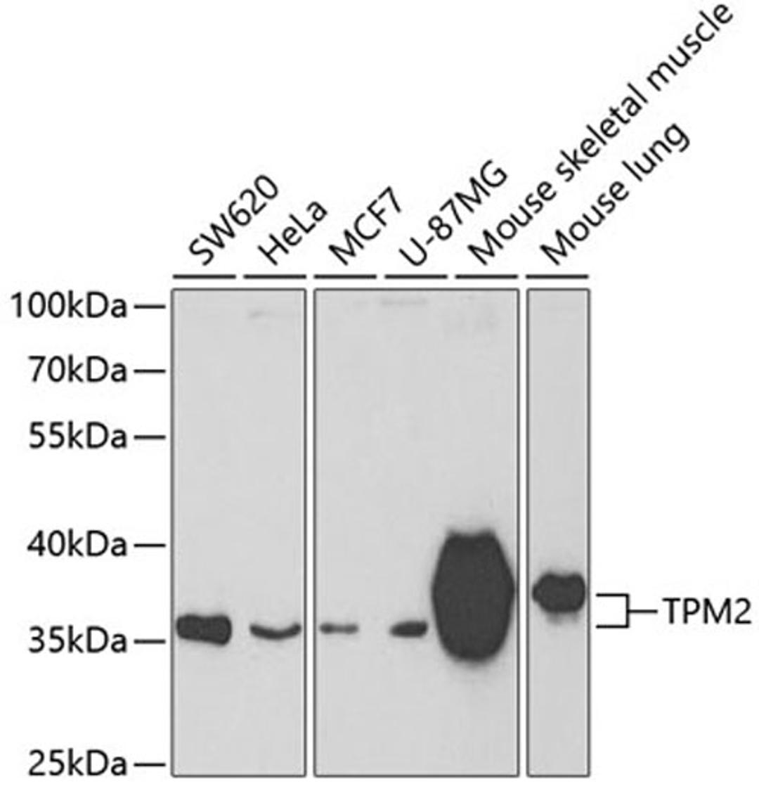 Western blot - TPM2 antibody (A3096)