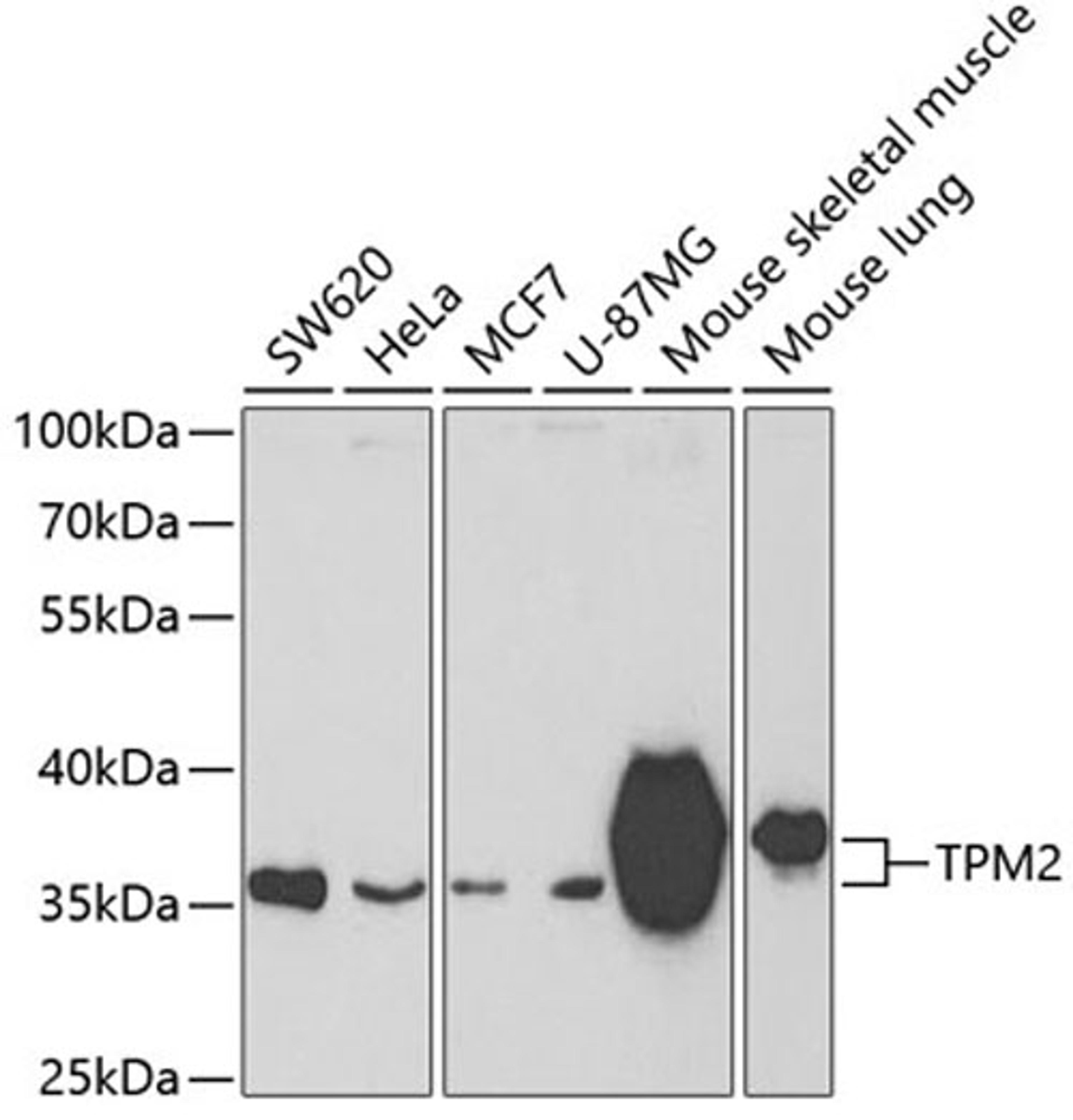 Western blot - TPM2 antibody (A3096)