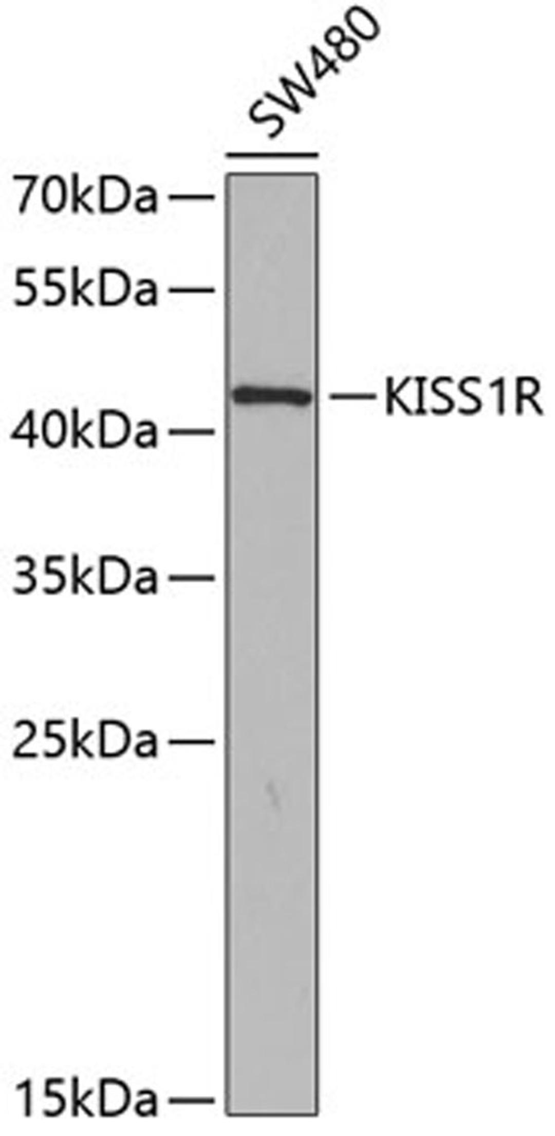 Western blot - KISS1R antibody (A2967)