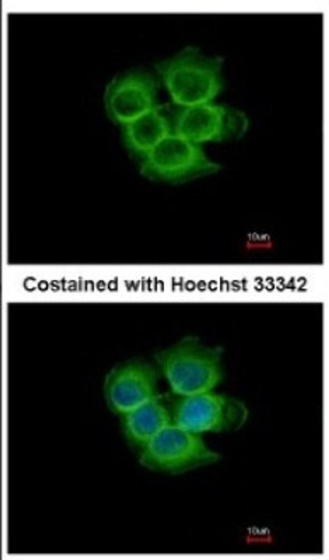 Immunocytochemistry/Immunofluorescence: IL17RD Antibody [NBP2-16944] - Immunofluorescence analysis of methanol-fixed MCF-7, using antibody at 1:500 dilution.