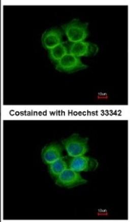 Immunocytochemistry/Immunofluorescence: IL17RD Antibody [NBP2-16944] - Immunofluorescence analysis of methanol-fixed MCF-7, using antibody at 1:500 dilution.