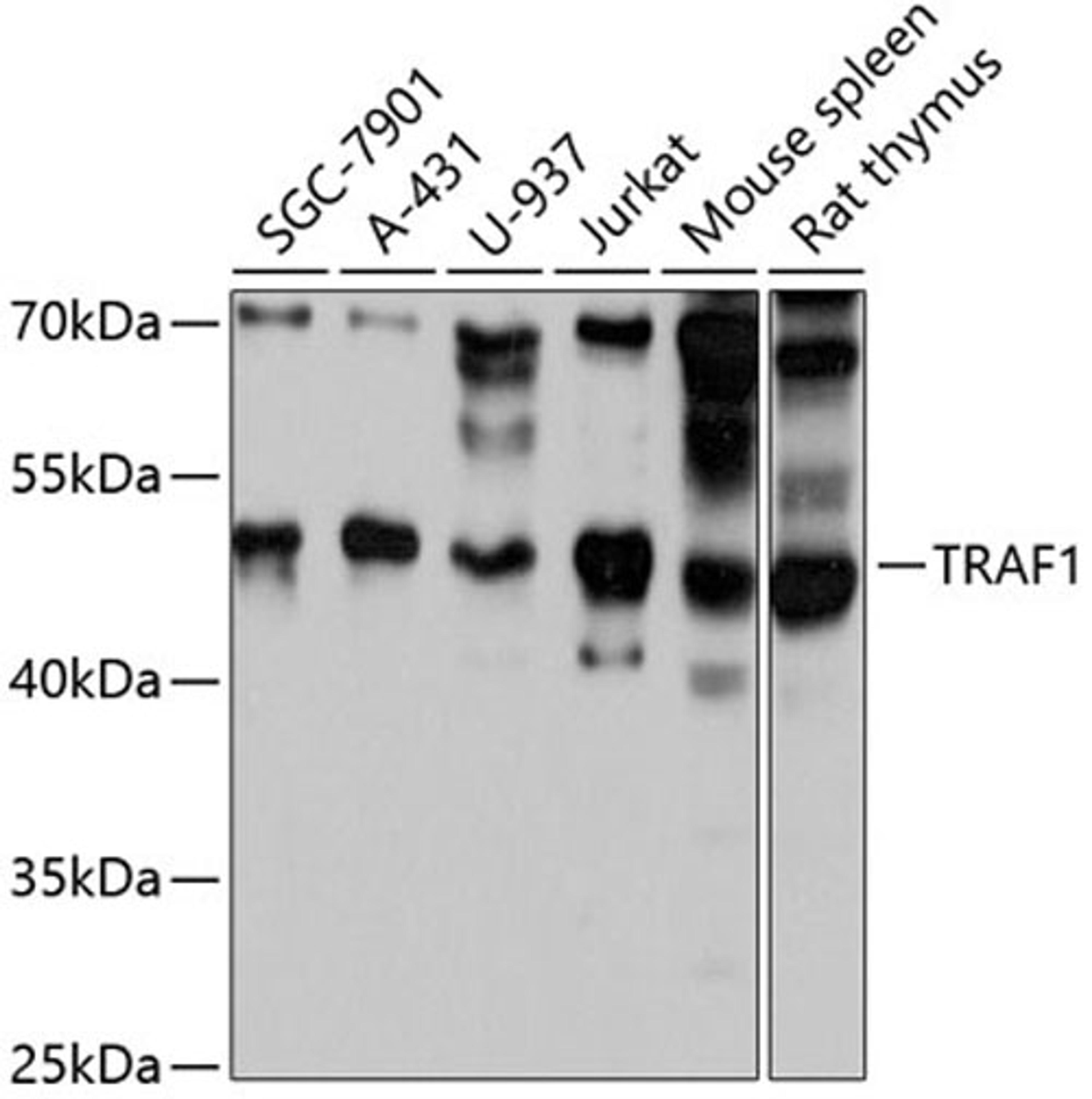 Western blot - TRAF1 antibody (A0150)