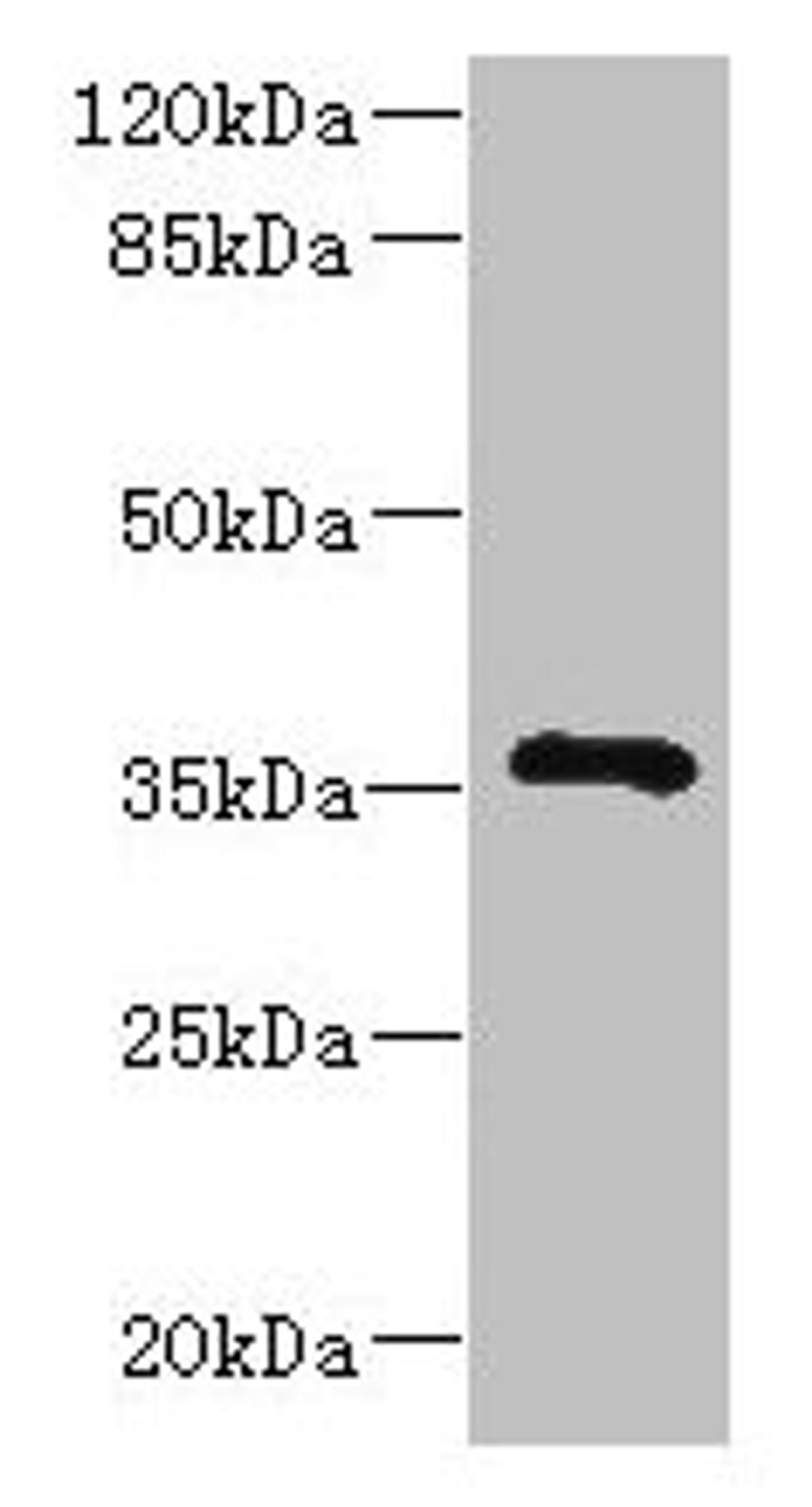 Western blot. All lanes: GIMAP7 antibody at 2µg/ml + Jurkat whole cell lysate. Secondary. Goat polyclonal to rabbit IgG at 1/10000 dilution. Predicted band size: 35 kDa. Observed band size: 35 kDa