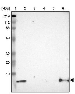 Western Blot: Cystatin A Antibody [NBP1-86989] - Lane 1: Marker [kDa] 219, 112, 85, 49, 32, 25, 18<br/>Lane 2: Human cell line RT-4<br/>Lane 3: Human cell line U-251MG sp<br/>Lane 4: Human cell line A-431<br/>Lane 5: Human liver tissue<br/>Lane 6: Human tonsil tissue