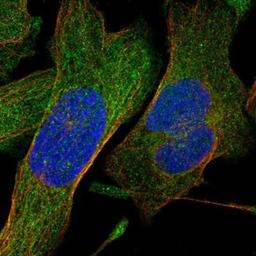 Immunocytochemistry/Immunofluorescence: SHMT1 Antibody [NBP1-85437] - Staining of human cell line U-2 OS shows positivity in nucleus & cytoplasm.