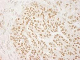 Detection of human PRMT6 by immunohistochemistry.