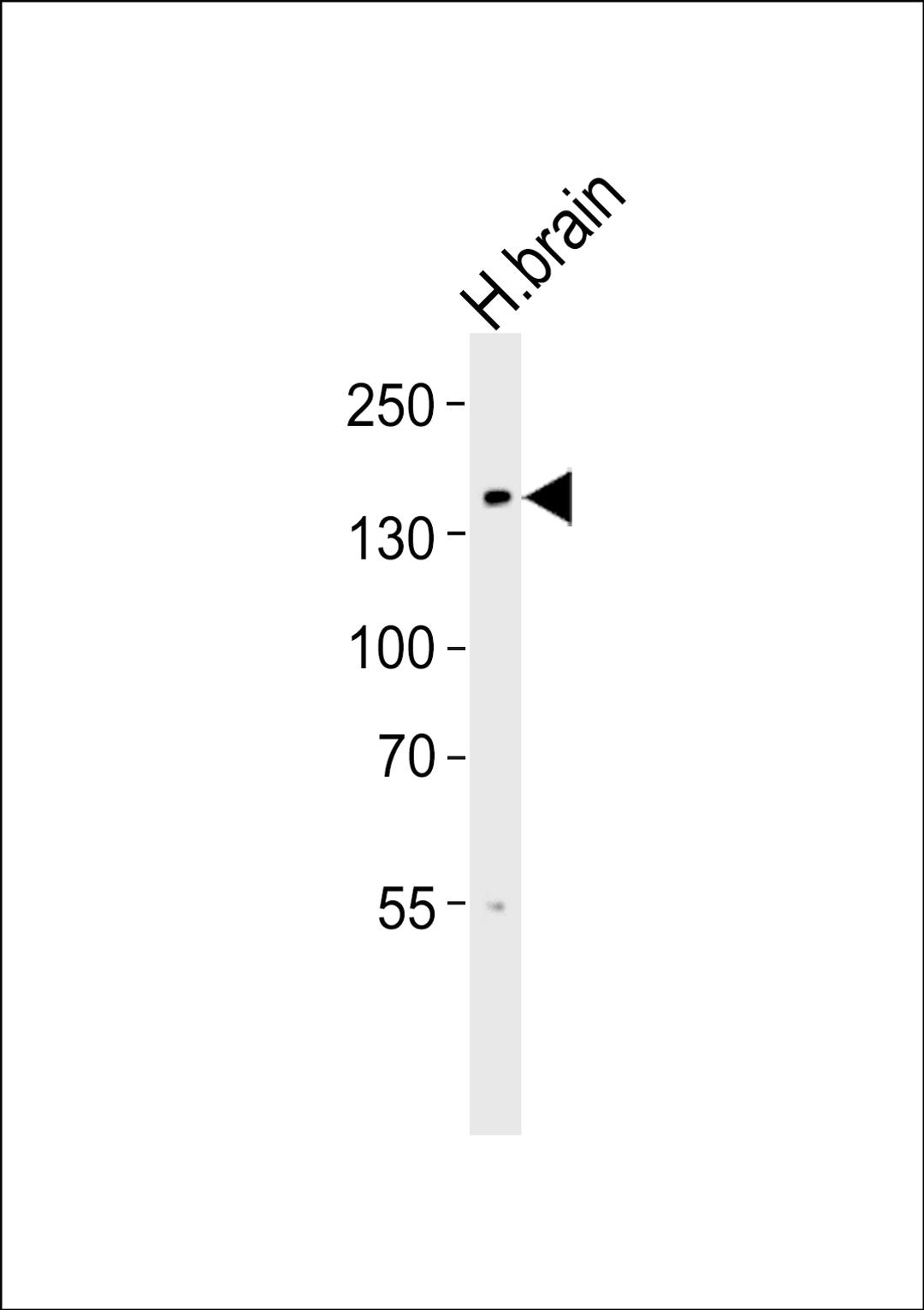 Western blot analysis of lysate from human brain tissue lysate, using at 1:1000.