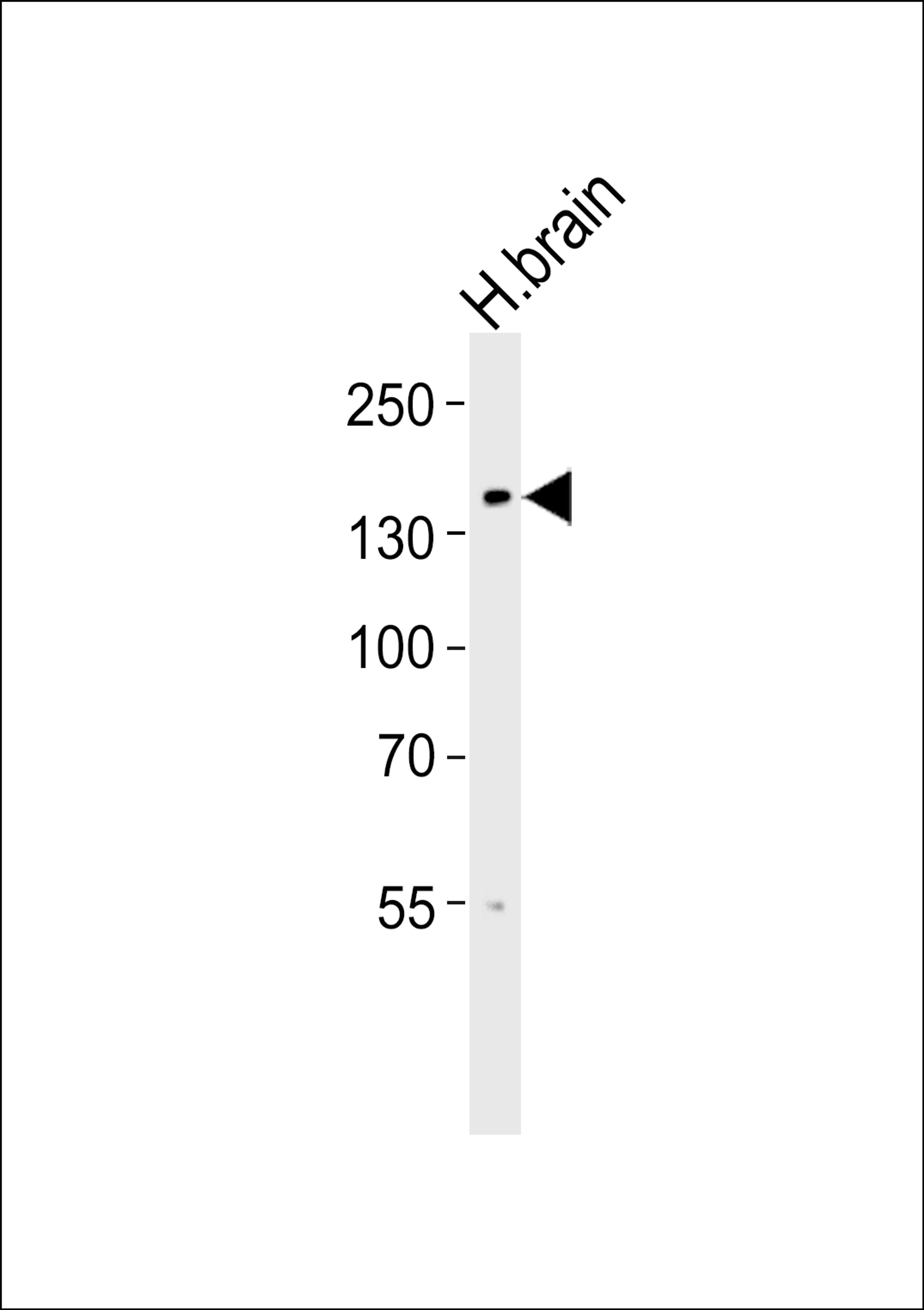 Western blot analysis of lysate from human brain tissue lysate, using at 1:1000.